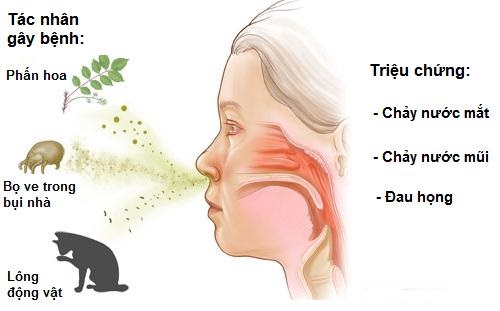 Bệnh viêm mũi dị ứng có những loại nào